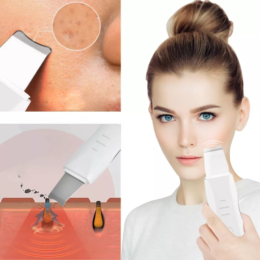 Limpiador Ultrasonico Hidrata Exfoliante